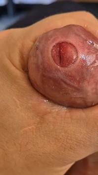 Phimosis Stepdaddy. Ight Foreskin Stroking Until I Leak Everywhere