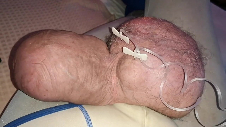 Monster_Meat_: Doppio ripieno di glucosio da 2listri