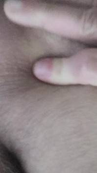 Dirty Anus