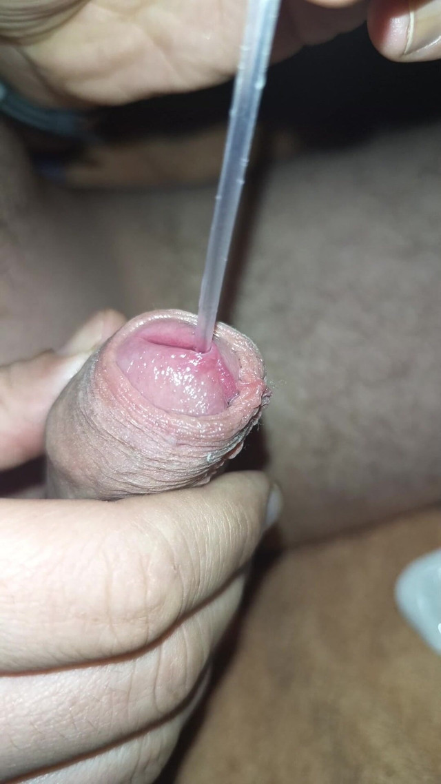 Ureal Insertion I'm Putting a Catheter in My Husband, It Hurts Him (Wild Life PA) Ureal Insertion I'm Putting a Catheter in My Husband, It Hurts Him (Wild Life PA)