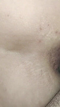 Side Anal