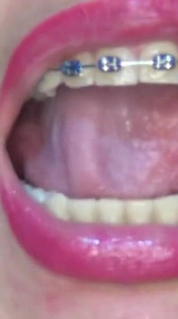 Playing and Swallowing a Candy-filled Condom in the Shape of a Rabbit