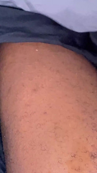 Hairy Trans Lady Dick Cumming