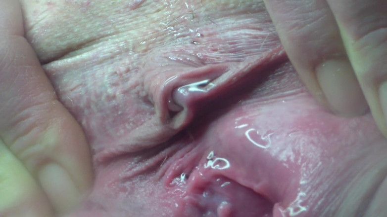 deep keely: คอมไพล์ฉี่ 5