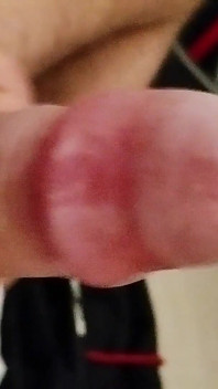 私の精子