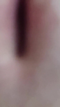 Quelles sont ces taches sur mon pénis