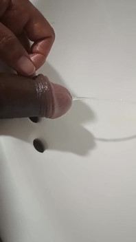 Kolekce Spousta moči, Nesestříhaný penis, Předkožka