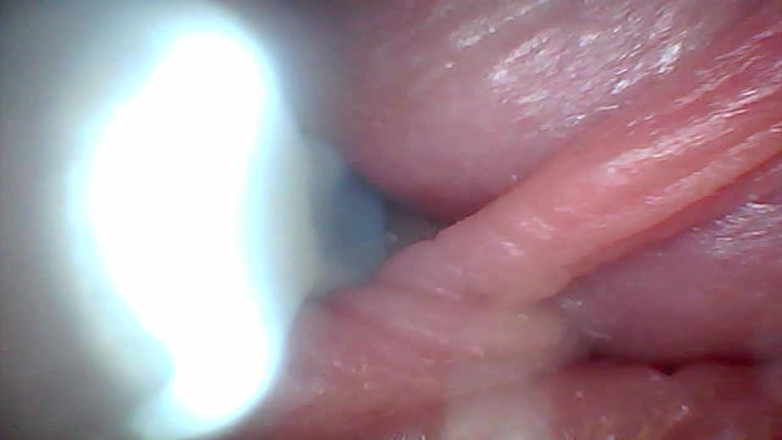 Twittiy: กล้องส่องกล้องในแสดงส่วนที่敏感ที่สุดของควย วิดีโอการศึกษา