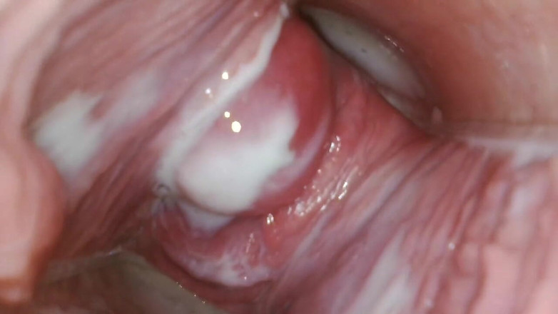 JANA studios: Endoscopio nella mia figa