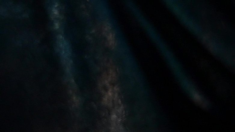 Sadic Sadie: Un long point de vue fantasmé médical.