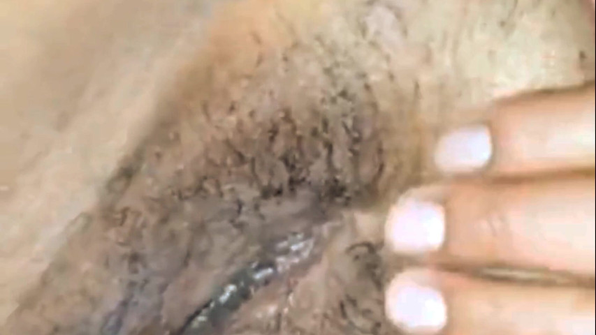 My Hedgehog Is Swollen and Wet (Fatisho)