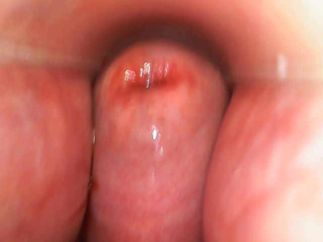 My Cervix up Close (TripleXTransMan)