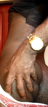 Caliente peludo culo de mí