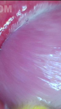 Sex Education with Jessie and the Tantaly Doll. an Endoscope in the Ass Showing Creampie Inside. Jessijek
