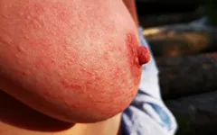 Nettle Punishment Day - Ass, Tits and Vagina in Outdoors - Dc