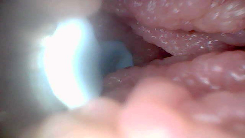 Twittiy: Jette Un Coup D’œil Dans Ma Chatte Juteuse Ensemble (caméra Endoscopique)