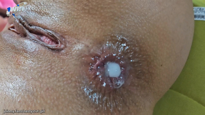 Nastystuf Girl: 壮大なアナル中出しコンピレーション - ザーメン噴出だけ