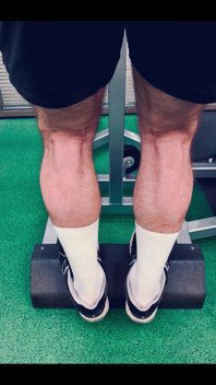 My Legs