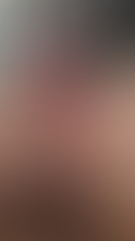 My Tight Uncut Phimosis Cock Stretched