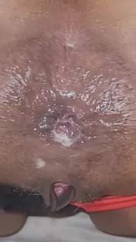 Trying to Get the Sperm Out, It Was so Deep That It Didn't Come Out