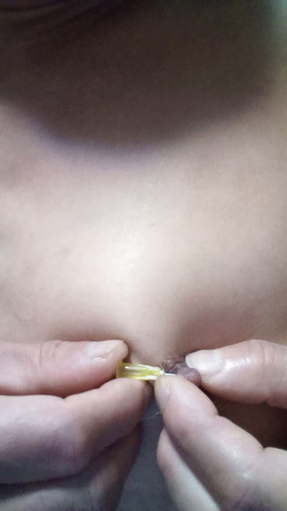 Osiritikubi: Bradavky jehly