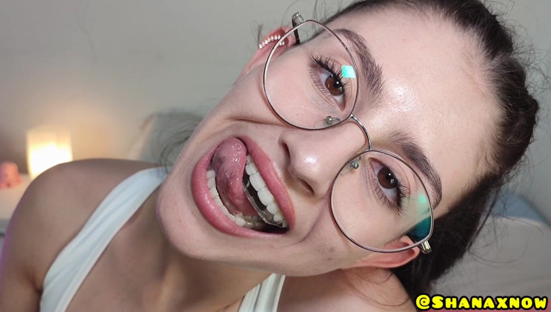 Shanaxnow: My Fetish Orthodontic Retainer Brace Tongue Teeth