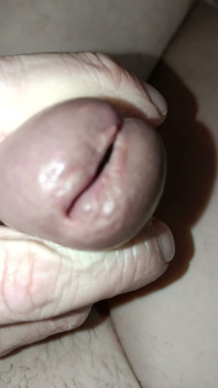 Is My Meatus Open?