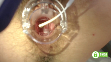 Miodelka: Gyno-examen met speculum close-up in harig poesje