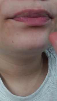 Moja przyrodnia siostra gigantka gra dentystę z małym przyrodnim bratem,