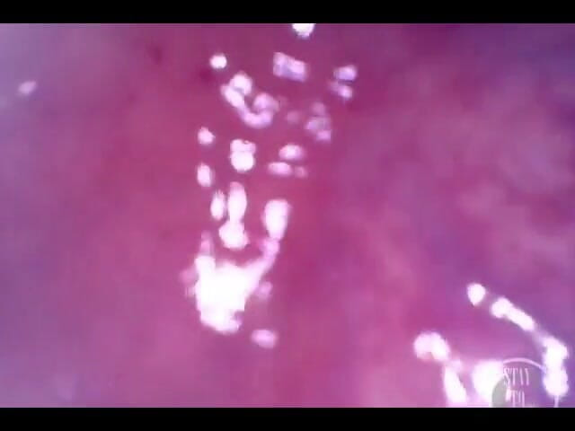 Lina Free: En primer plano - examen anal extremo y profundo!