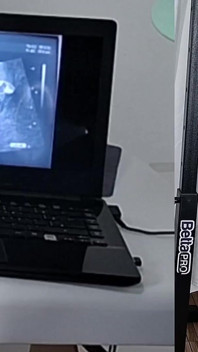 Gynekolog provádí ultrazvuk jinak vedle paroháče