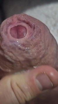 Uncut Tight Phimosis Cock Foreskin Stretched Close up