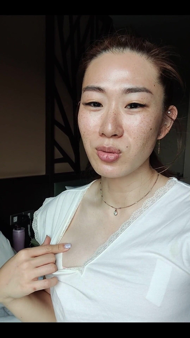 Day 3 Post Op (Aerie Rei) Day 3 Post Op (Aerie Rei)
