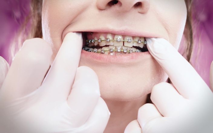 Arya Grander: Asmr: kawat gigi yang ditingkatkan dengan gelang karet chain-link dan...