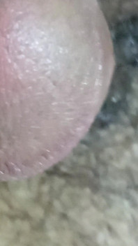 My Dick