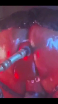 Intense Verbal Play Ahead...