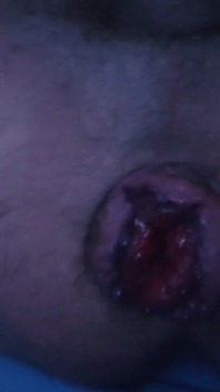 Playing with My Rosebud'd Pig Hole