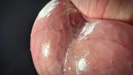 Massaggia le uova e poi vieni