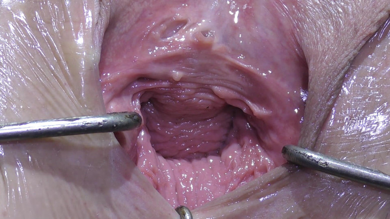deep keely: Khoảng trống xa