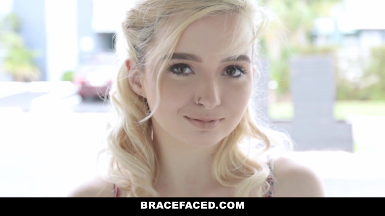 Team Skeet: The bracefaced hook up