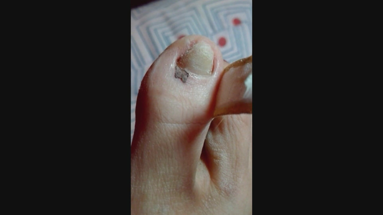 Miss Wagon Vegan Fetish: Miss Wagon Vegan - sawn imagining untuk mengisap ku yang ingrown...