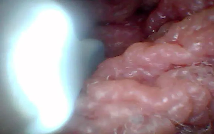 Twittiy: Endoscope Camera Shows the Most Sensitive Parts of the Penis...