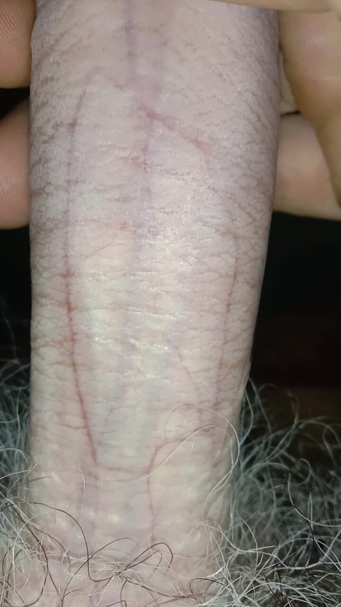 PenisCatch: Băiat tânăr de 26 de ani