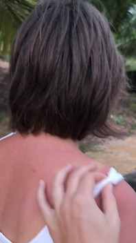 She Really Likes to Sunburn