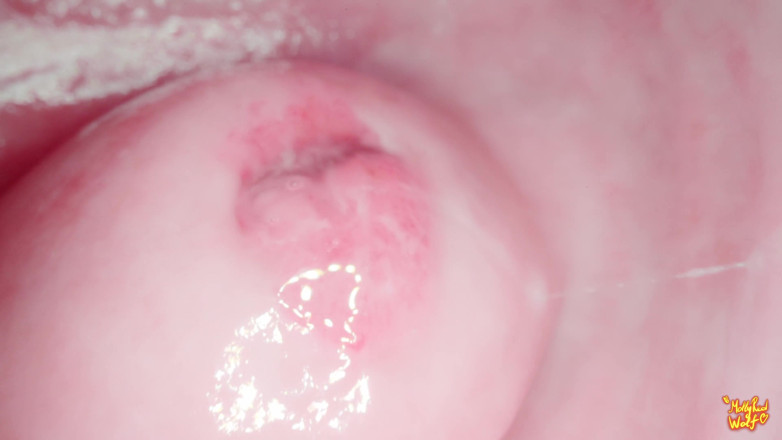 MollyRedWolf: Hey Stepbrother! Let's Play Gynecologist? Gyno, Endoscopy - Mollyredwolf