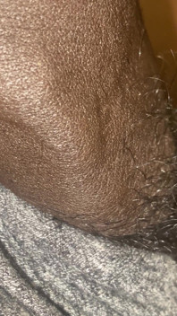 Meat Teaser