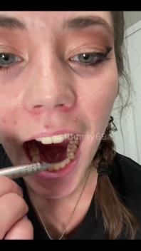 Sadistic Dental Cleaning