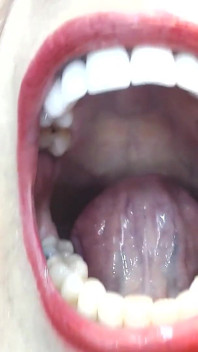 Uvula di denti dentro la mia bocca grande lingua