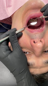 La coniglietta infermiera controlla i denti del dr. Canada con multi angolazione