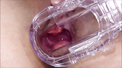 Helena Moeller: Pohled na děložní zrcátko v kundičce zblízka